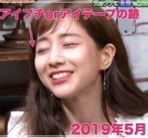 画像比較 田中みな実はデビュー当時と顔が変わりすぎ アイプチで二重疑惑も 芸能summary